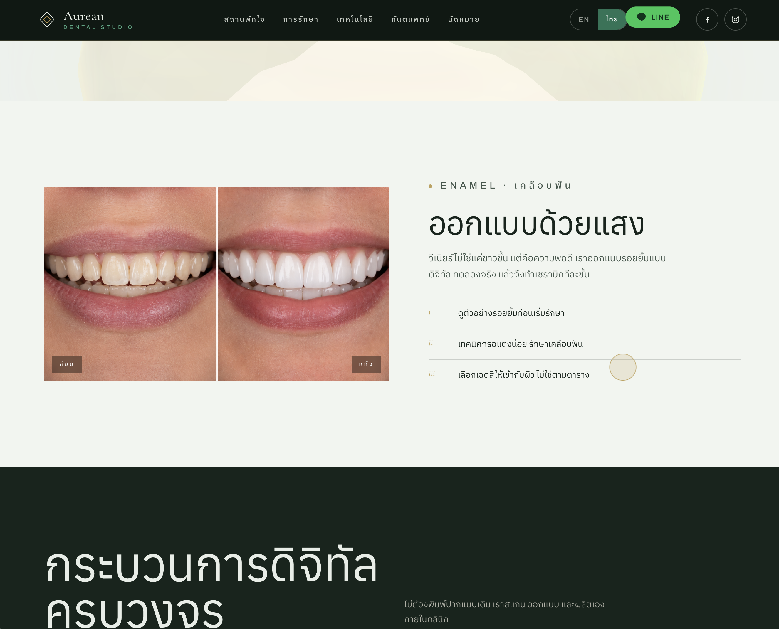 Aurean Dental Studio — Enamel veneers section with a before-and-after smile comparison